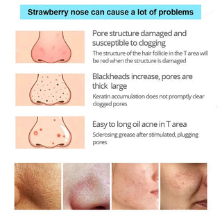 Parches de Carbón de Bambú para Eliminar Puntos Negros